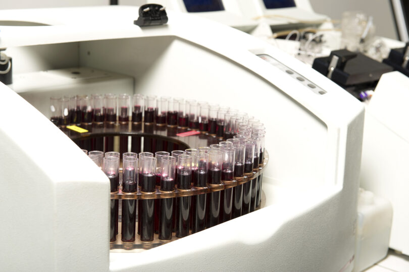 Os estudos científicos sobre epidemiologia nutricional – algumas reflexões sobre o seu valor científico real